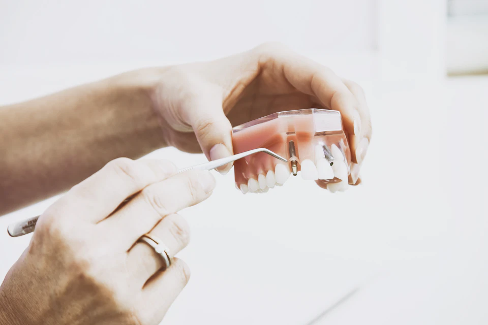 Mains tenant un instrument dentaire près d'un modèle d'implant dentaire transparent