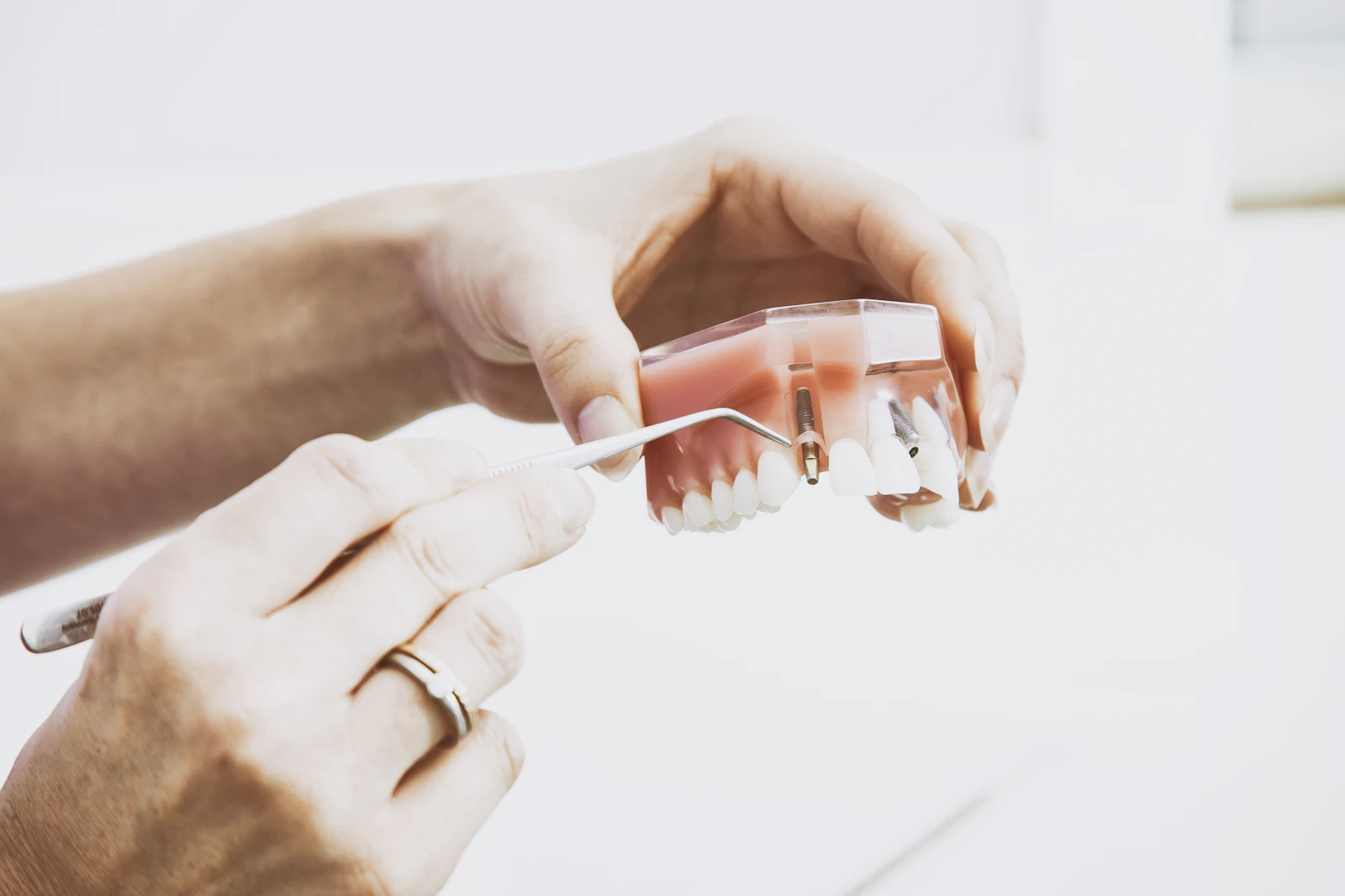 Mains tenant un instrument dentaire près d'un modèle d'implant dentaire transparent